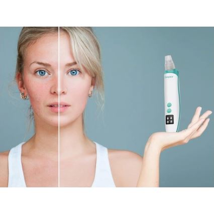 Beper - Wiederaufladbarer Porenreiniger USB/5V 400 mAh